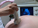 Picture of doctor giving an ultrasound Picture of doctor giving an ultrasound